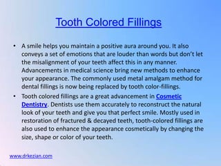 Tooth Colored Fillings

 • A smile helps you maintain a positive aura around you. It also
   conveys a set of emotions that are louder than words but don’t let
   the misalignment of your teeth affect this in any manner.
   Advancements in medical science bring new methods to enhance
   your appearance. The commonly used metal amalgam method for
   dental fillings is now being replaced by tooth color-fillings.
 • Tooth colored fillings are a great advancement in Cosmetic
   Dentistry. Dentists use them accurately to reconstruct the natural
   look of your teeth and give you that perfect smile. Mostly used in
   restoration of fractured & decayed teeth, tooth-colored fillings are
   also used to enhance the appearance cosmetically by changing the
   size, shape or color of your teeth.

www.drkezian.com
 