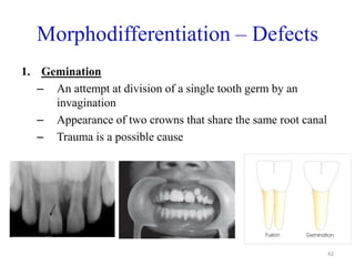 Tooth Defects Animation Development of Teeth | PPTX