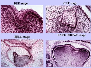 BUD stage       CAP stage




             LATE CROWN stage
BELL stage
 