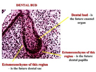 DENTAL BUD


                                      Dental bud - is
                                     the future enamel
                                           organ




                                Ectomesenchyme of this
                                 region – is the future
                                    dental papilla
Ectomesenchyme of this region
   – is the future dental sac
 