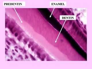 PREDENTIN   ENAMEL



                DENTIN
 