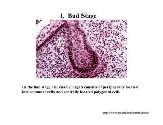 1. Bud Stage




In the bud stage, the enamel organ consists of peripherally located
low columnar cells and centrally located polygonal cells




                                              http://www.usc.edu/hsc/dental/ohisto/
 