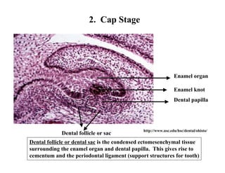 2. Cap Stage




                                                               Enamel organ

                                                               Enamel knot
                                                               Dental papilla




                                              http://www.usc.edu/hsc/dental/ohisto/
             Dental follicle or sac
Dental follicle or dental sac is the condensed ectomesenchymal tissue
surrounding the enamel organ and dental papilla. This gives rise to
cementum and the periodontal ligament (support structures for tooth)
 