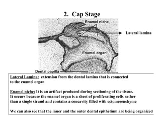 2. Cap Stage

                                                                    Lateral lamina




Lateral Lamina: extension from the dental lamina that is connected
to the enamel organ

Enamel niche: It is an artifact produced during sectioning of the tissue.
It occurs because the enamel organ is a sheet of proliferating cells rather
than a single strand and contains a concavity filled with ectomesenchyme

We can also see that the inner and the outer dental epithelium are being organized
 