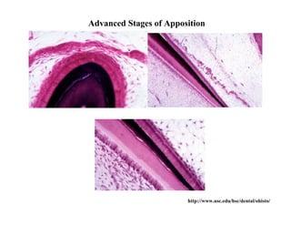 Advanced Stages of Apposition




                        http://www.usc.edu/hsc/dental/ohisto/
 