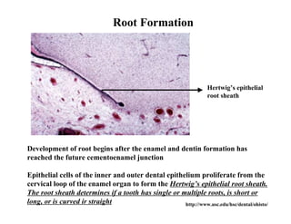 Root Formation




                                                                   Hertwig’s epithelial
                                                                   root sheath




Development of root begins after the enamel and dentin formation has
reached the future cementoenamel junction

Epithelial cells of the inner and outer dental epithelium proliferate from the
cervical loop of the enamel organ to form the Hertwig’s epithelial root sheath.
The root sheath determines if a tooth has single or multiple roots, is short or
long, or is curved ir straight                       http://www.usc.edu/hsc/dental/ohisto/
 