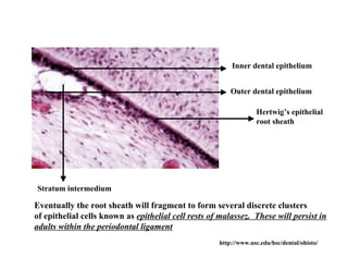 Inner dental epithelium


                                                         Outer dental epithelium

                                                                  Hertwig’s epithelial
                                                                  root sheath




Stratum intermedium

Eventually the root sheath will fragment to form several discrete clusters
of epithelial cells known as epithelial cell rests of malassez. These will persist in
adults within the periodontal ligament
                                                     http://www.usc.edu/hsc/dental/ohisto/
 