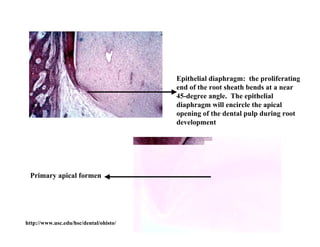 Epithelial diaphragm: the proliferating
                                        end of the root sheath bends at a near
                                        45-degree angle. The epithelial
                                        diaphragm will encircle the apical
                                        opening of the dental pulp during root
                                        development




 Primary apical formen




http://www.usc.edu/hsc/dental/ohisto/
 