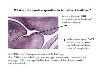 What are the signals responsible for initiation of tooth bud?
                                                   In the epithelium: SHH
                                                   expression marks the sites of
                                                   tooth development




                                                       In the mesenchyme, PAX9
                                                       and Activin expression
                                                       marks the sites of future
                                                       epithelial invagination

Pax9 KO - tooth development arrested at the bud stage
Runx2 KO – arrest at bud stage however upper molars make it to an aberrant
cap stage. Difference explained by the expression of Runx3 in the maxilla
and not mandible.
 