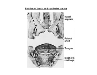 Position of dental and vestibular lamina
 