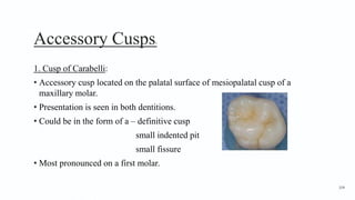 Accessory Cusps2
1. Cusp of Carabelli:
• Accessory cusp located on the palatal surface of mesiopalatal cusp of a
maxillary molar.
• Presentation is seen in both dentitions.
• Could be in the form of a – definitive cusp
small indented pit
small fissure
• Most pronounced on a first molar.
104
 