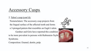 Accessory Cusps6
2. Talon’s cusp (cont’d):
Nomenclature: The accessory cusp projects from
the lingual surface of the affected tooth and forms
a 3-pronged pattern that resembles an Eagle’s talon.
Gardner and Giris have reported this condition
to be more prevalent in persons with Rubinstein-Taybi
Syndrome.
Composition: Enamel, dentin, pulp.
108
 