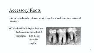 Accessory Roots1
• An increased number of roots are developed in a tooth compared to normal
anatomy.
• Clinical and Radiological Features:
Both dentitions are affected.
Prevalence – third molars
bicuspids
cuspids
114
 
