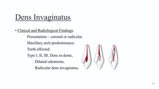 Dens Invaginatus2
• Clinical and Radiological Findings:
Presentation – coronal or radicular.
Maxillary arch predominance.
Teeth affected.
Type I, II, III, Dens in dente,
Dilated odontome,
Radicular dens invaginatus.
117
 