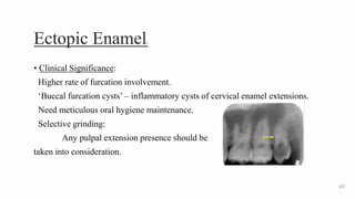 Ectopic Enamel3
• Clinical Significance:
Higher rate of furcation involvement.
‘Buccal furcation cysts’ – inflammatory cysts of cervical enamel extensions.
Need meticulous oral hygiene maintenance.
Selective grinding:
Any pulpal extension presence should be
taken into consideration.
127
 