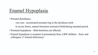 Enamel Hypoplasia2
• Prenatal disturbance
very rare - accentuated neonatal ring in the deciduous teeth
in severe forms, enamel formation arrested at birth/during neonatal period.
• Postnatal hypoplasia – Both dentitions are affected.
• Enamel hypoplasia is common in prematurely born, LBW children – Seow and
colleagues. (? mineral deficiency)
135
 