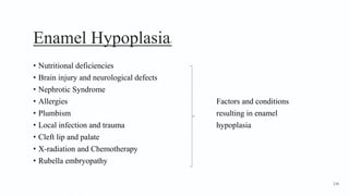 Enamel Hypoplasia3
• Nutritional deficiencies
• Brain injury and neurological defects
• Nephrotic Syndrome
• Allergies Factors and conditions
• Plumbism resulting in enamel
• Local infection and trauma hypoplasia
• Cleft lip and palate
• X-radiation and Chemotherapy
• Rubella embryopathy
136
 
