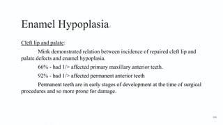 Enamel Hypoplasia13
Cleft lip and palate:
Mink demonstrated relation between incidence of repaired cleft lip and
palate defects and enamel hypoplasia.
66% - had 1/> affected primary maxillary anterior teeth.
92% - had 1/> affected permanent anterior teeth
Permanent teeth are in early stages of development at the time of surgical
procedures and so more prone for damage.
146
 