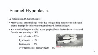 Enamel Hypoplasia14
X-radiation and Chemotherapy:
• Many dental abnormalities result due to high-dose exposure to radio and
chemo-therapy in children during their tooth formation ages.
• Kaste and colleagues studied acute lymphoblastic leukemia survivors and
found - root stunting – 24%
microdontia – 19%
hypodontia – 8%
taurodontia – 6%
over retention of primary teeth – 4%
147
 