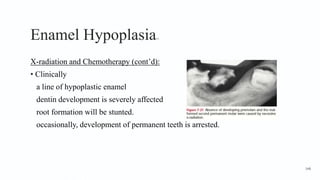 Enamel Hypoplasia15
X-radiation and Chemotherapy (cont’d):
• Clinically
a line of hypoplastic enamel
dentin development is severely affected
root formation will be stunted.
occasionally, development of permanent teeth is arrested.
148
 