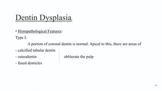 Dentin Dysplasia6
• Histopathological Features:
Type I:
A portion of coronal dentin is normal. Apical to this, there are areas of
- calcified tubular dentin
- osteodentin obliterate the pulp
- fused denticles
155
 