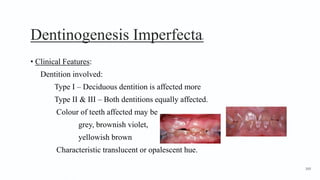 Dentinogenesis Imperfecta4
• Clinical Features:
Dentition involved:
Type I – Deciduous dentition is affected more
Type II & III – Both dentitions equally affected.
Colour of teeth affected may be
grey, brownish violet,
yellowish brown
Characteristic translucent or opalescent hue.
169
 