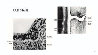 BUD STAGE
29
 