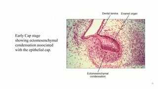 Early Cap stage
showing ectomesenchymal
condensation associated
with the epithelial cap.
31
 