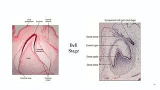 Bell
Stage
44
 