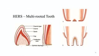 HERS – Multi-rooted Tooth
51
 