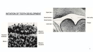 INITIATION OF TOOTH DEVELOPMENT
55
 