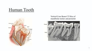 Human Tooth
Vertical Cone Beam CT Slice of
mandibular molars and premolar
6
 
