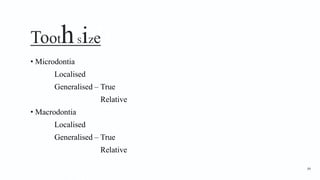 ToothSize
• Microdontia
Localised
Generalised – True
Relative
• Macrodontia
Localised
Generalised – True
Relative
84
 