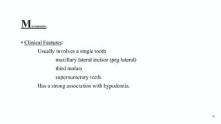 Microdontia3
• Clinical Features:
Usually involves a single tooth
maxillary lateral incisor (peg lateral)
third molars
supernumerary teeth.
Has a strong association with hypodontia.
88
 