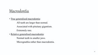 Macrodontia3
• True generalised macrodontia:
All teeth are larger than normal.
Associated with pituitary gigantism.
Extremely rare.
• Relative generalised macrodontia:
Normal teeth in smaller jaws.
Micrognathia rather than macrodontia.
92
 