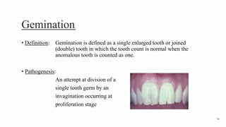 Gemination1
• Definition: Gemination is defined as a single enlarged tooth or joined
(double) tooth in which the tooth count is normal when the
anomalous tooth is counted as one.
• Pathogenesis:
An attempt at division of a
single tooth germ by an
invagination occurring at
proliferation stage
94
 