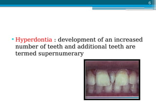 Tooth Growing In Tooth development disturbances 1.pdf.ppt