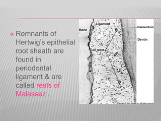  Remnants of
Hertwig’s epithelial
root sheath are
found in
periodontal
ligament & are
called rests of
Malassez .
 