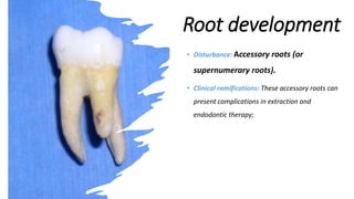 Tooth development along with clinical importance - Oral histology | PPTX