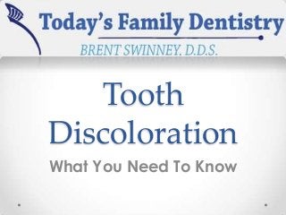 Tooth
Discoloration
What You Need To Know

 