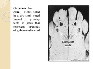 Gubernacular
canal: Holes noted
in a dry skull noted
lingual to primary
teeth in jaws that
represent openings
of gubernacular cord
.
 
