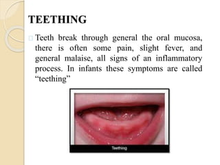 TEETHING
Teeth break through general the oral mucosa,
there is often some pain, slight fever, and
general malaise, all signs of an inflammatory
process. In infants these symptoms are called
“teething”
 