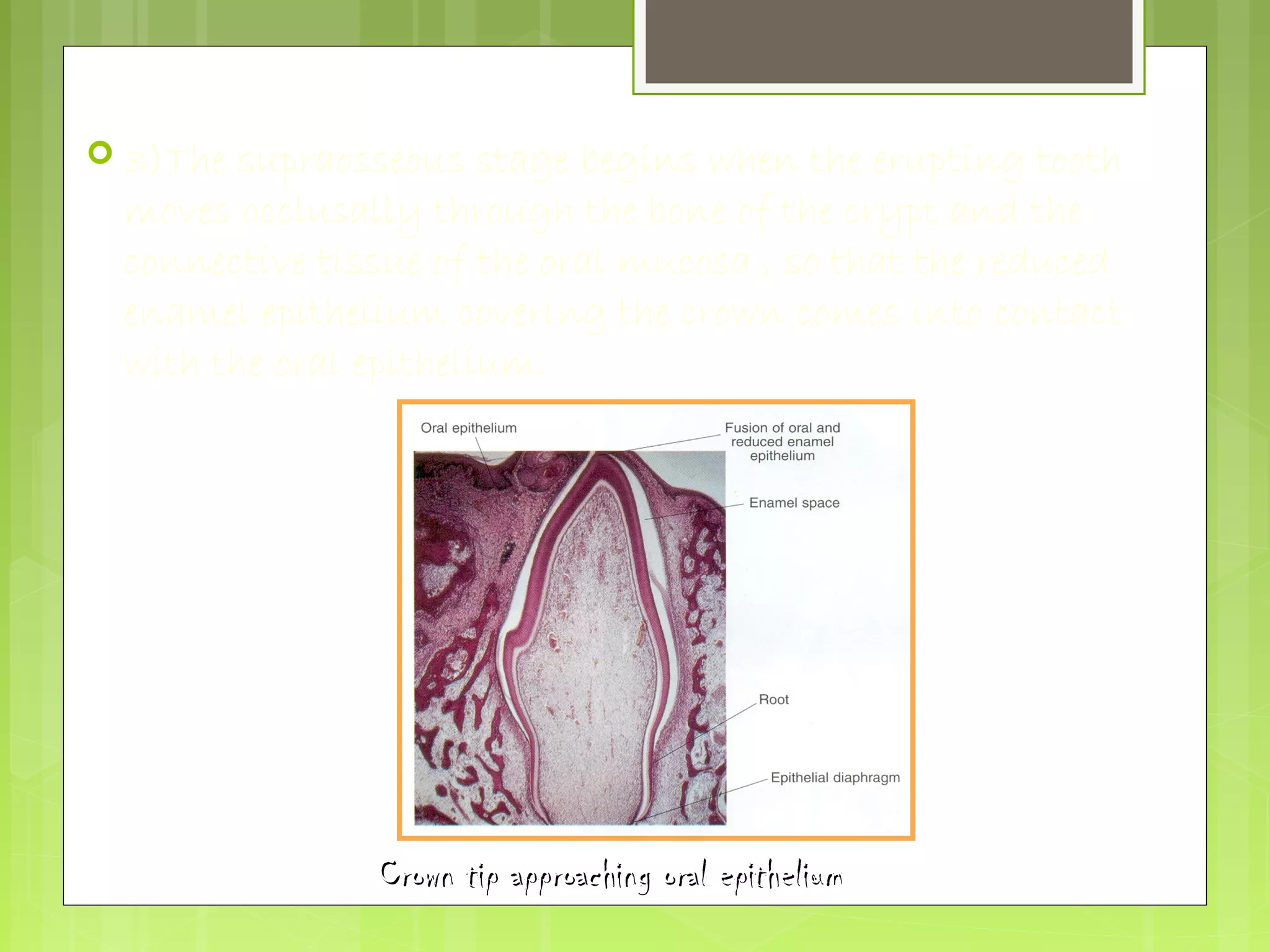  3)The supraosseous stage begins when the erupting tooth 
moves occlusally through the bone of the crypt and the 
connective tissue of the oral mucosa , so that the reduced 
enamel epithelium covering the crown comes into contact 
with the oral epithelium. 
Crown tip aapppprrooaacchhiinngg oorraall eeppiitthheelliiuumm 
 