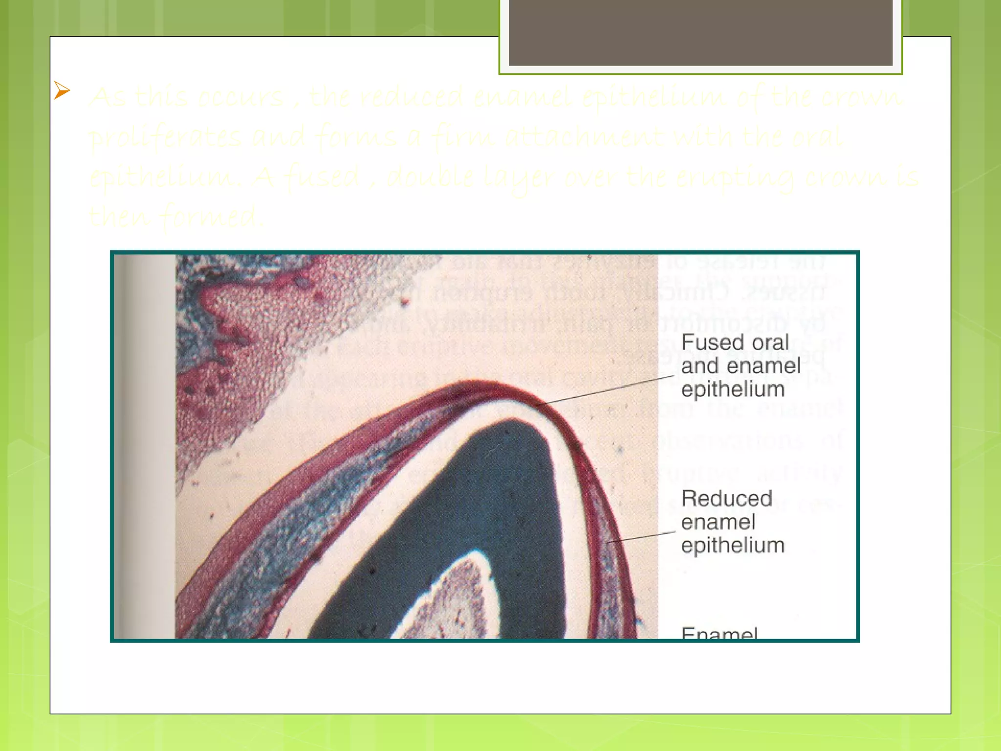  As this occurs , the reduced enamel epithelium of the crown 
proliferates and forms a firm attachment with the oral 
epithelium. A fused , double layer over the erupting crown is 
then formed. 
Contact and fusion of REE and oral mucosa 
 