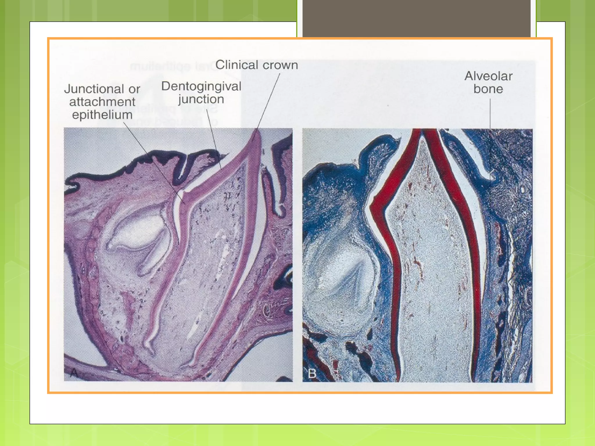 Clinical appearance of crown 
 