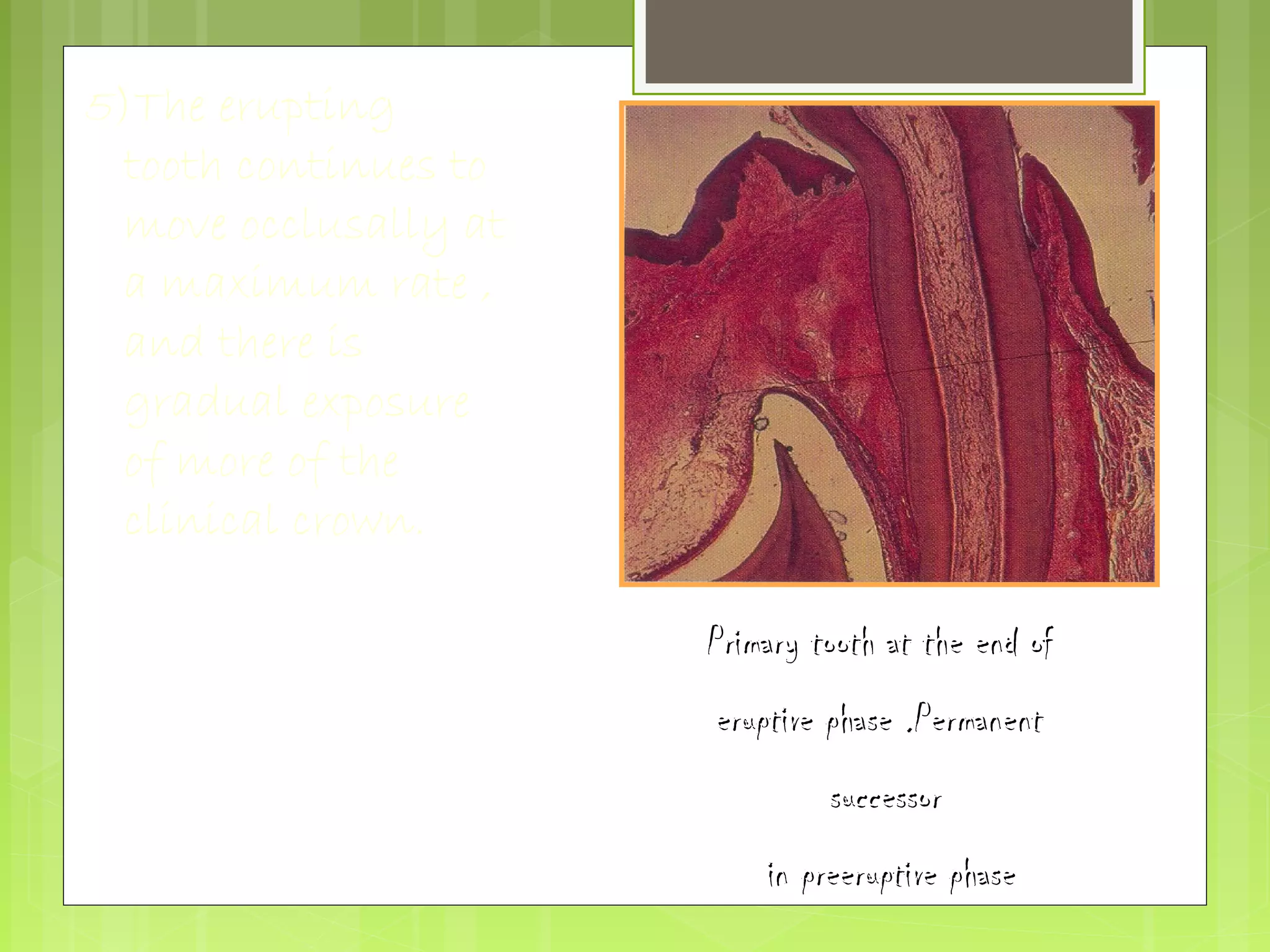5)The erupting 
tooth continues to 
move occlusally at 
a maximum rate , 
and there is 
gradual exposure 
of more of the 
clinical crown. 
PPrriimmaarryy ttooootthh aatt tthhee eenndd ooff 
eerruuppttiivvee pphhaassee ..PPeerrmmaanneenntt 
ssuucccceessssoorr 
iinn pprreeeerruuppttiivvee pphhaassee 
 