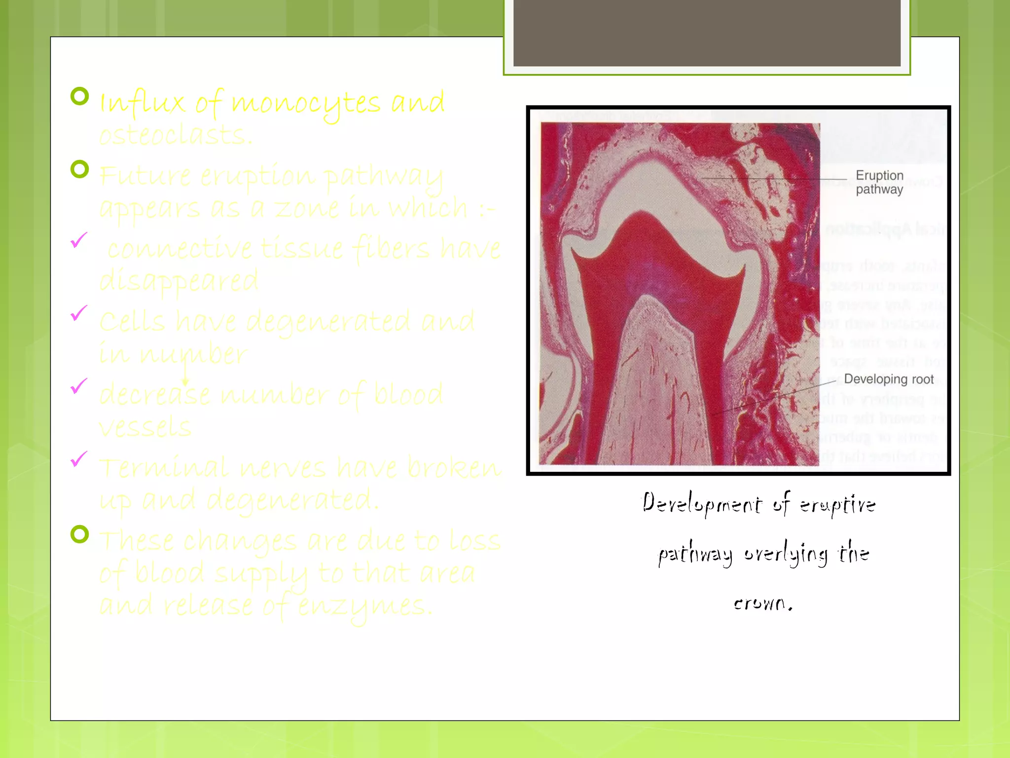  Influx of monocytes and 
osteoclasts. 
 Future eruption pathway 
appears as a zone in which :- 
 connective tissue fibers have 
disappeared 
 Cells have degenerated and 
in number 
 decrease number of blood 
vessels 
 Terminal nerves have broken 
up and degenerated. 
 These changes are due to loss 
of blood supply to that area 
and release of enzymes. 
DDeevveellooppmmeenntt ooff eerruuppttiivvee 
ppaatthhwwaayy oovveerrllyyiinngg tthhee 
ccrroowwnn.. 
 