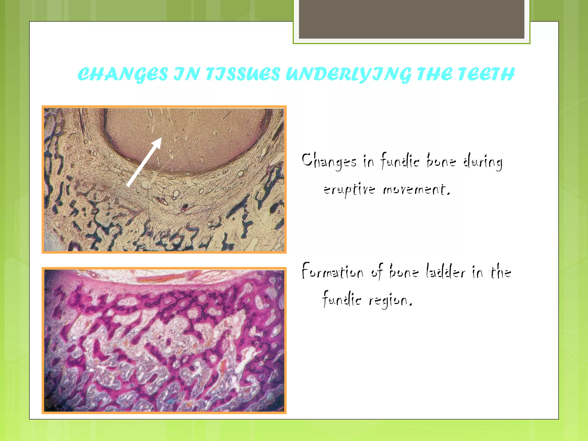 CHANGES IN TISSUES UNDERLYING THE TEETH 
CChhaannggeess iinn ffuunnddiicc bboonnee dduurriinngg 
eerruuppttiivvee mmoovveemmeenntt.. 
FFoorrmmaattiioonn ooff bboonnee llaaddddeerr iinn tthhee 
ffuunnddiicc rreeggiioonn.. 
 
