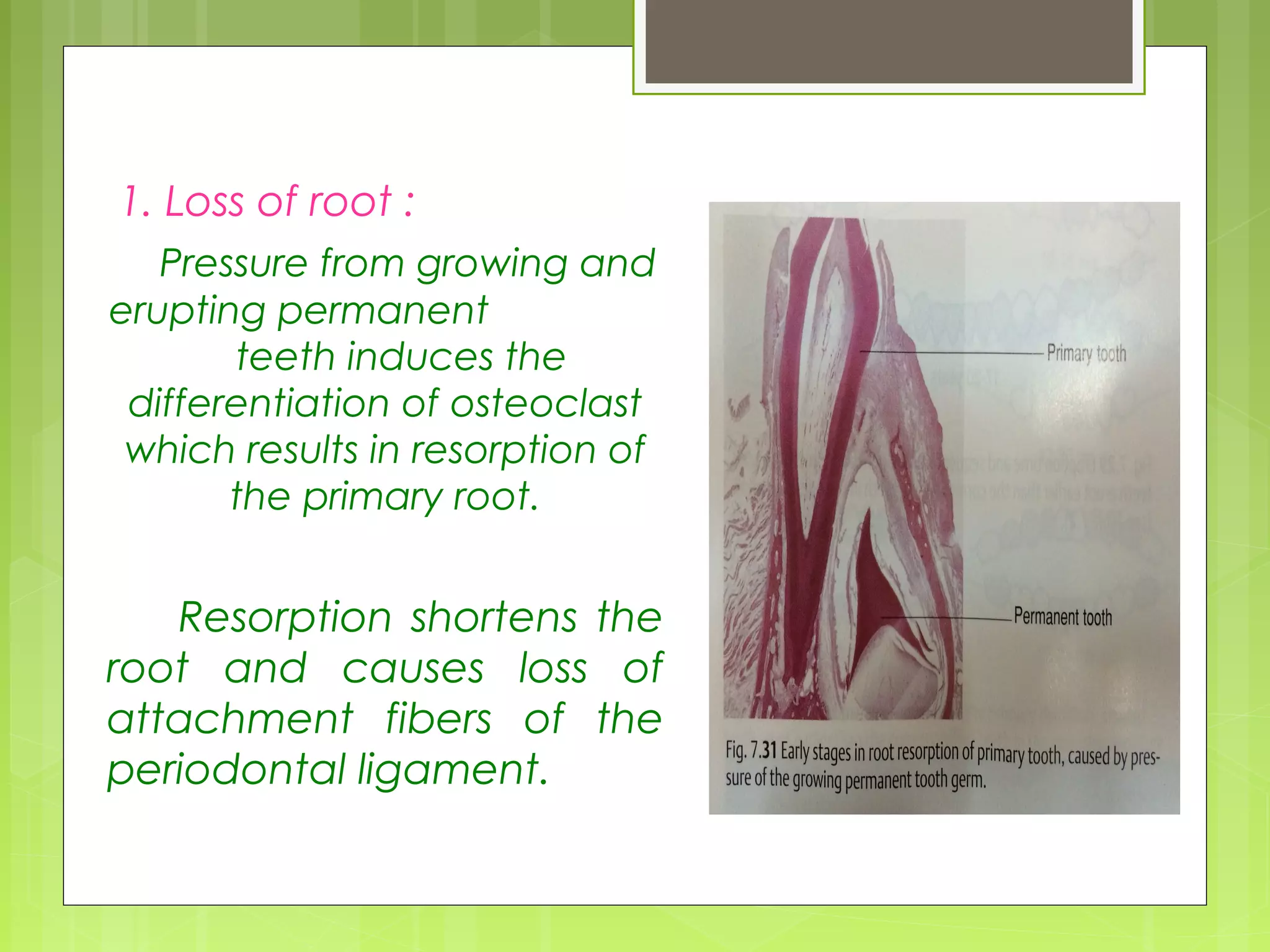 1. Loss of root : 
Pressure from growing and 
erupting permanent 
teeth induces the 
differentiation of osteoclast 
which results in resorption of 
the primary root. 
Resorption shortens the 
root and causes loss of 
attachment fibers of the 
periodontal ligament. 
 