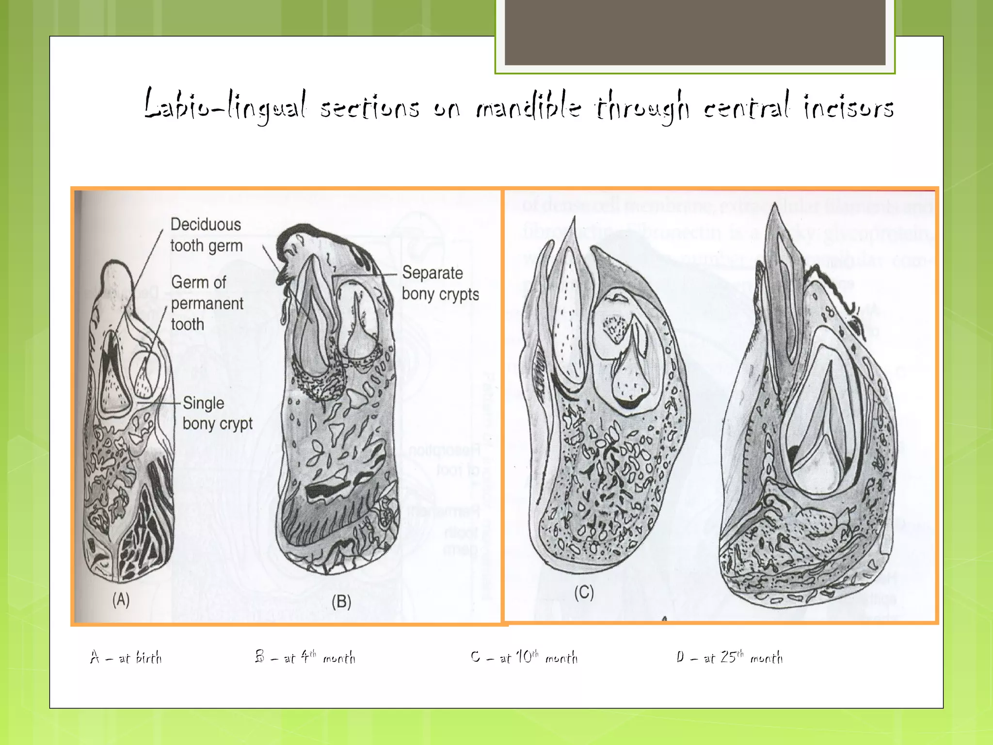 Labio-lingual sections on mmaannddiibbllee tthhrroouugghh cceennttrraall iinncciissoorrss 
AA –– aatt bbiirrtthh BB –– aatt 44tthh mmoonntthh CC –– aatt 1100tthh mmoonntthh DD –– aatt 2255tthh mmoonntthh 
 